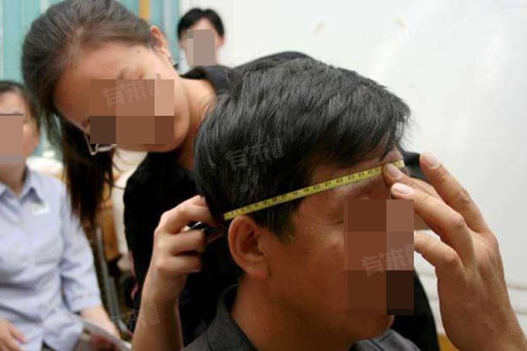 成年人头围的一般范围及其影响因素