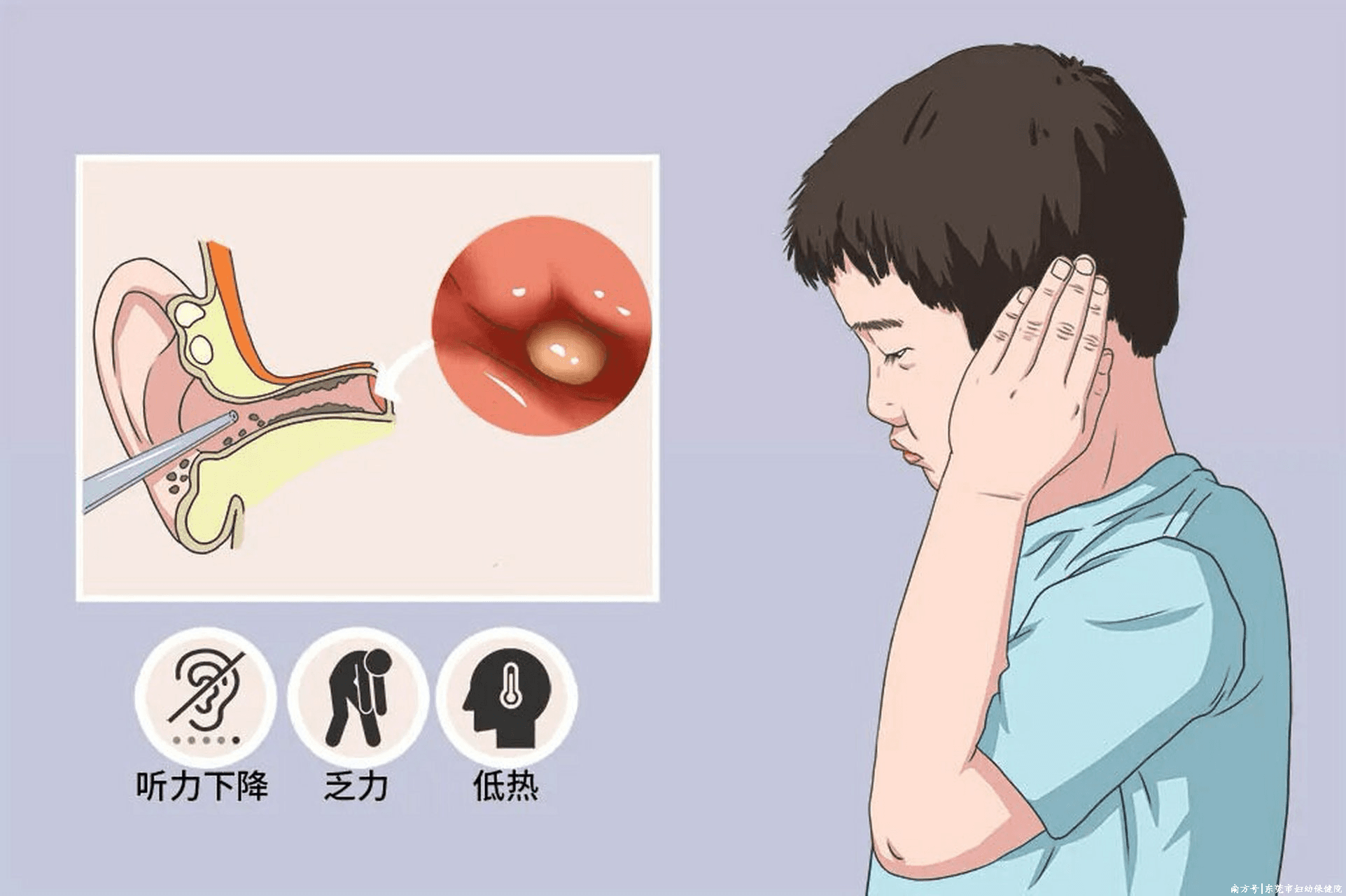 流感季节，怎样防治中耳炎？