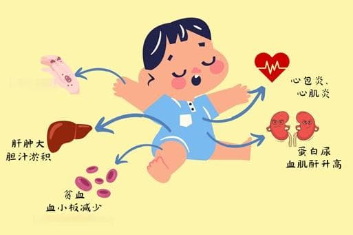 抗核抗体阳性！！别慌，不一定是红斑狼疮“判决书”