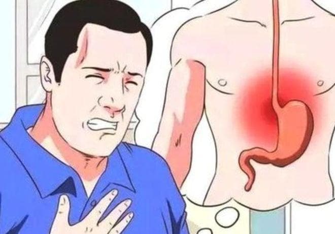 胃酸翻滚？做到这5点，让胃食管反流病远离你！
