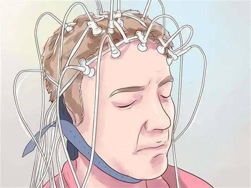 癫痫专家张秀云——脑电图检查有什么用？要做多久？