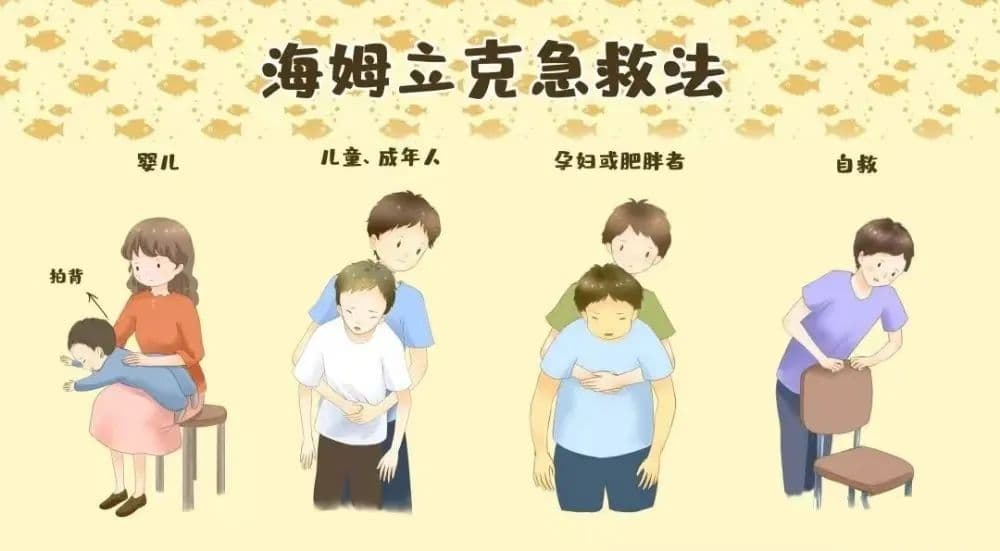 儿童异物卡喉如何急救？记住这个方法