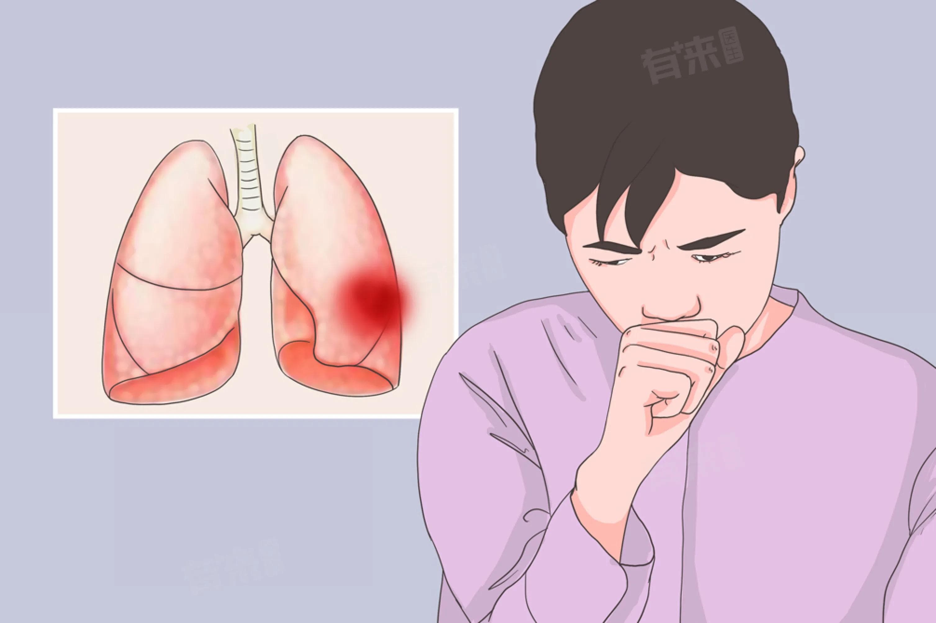 热咳和寒咳的鉴别方法