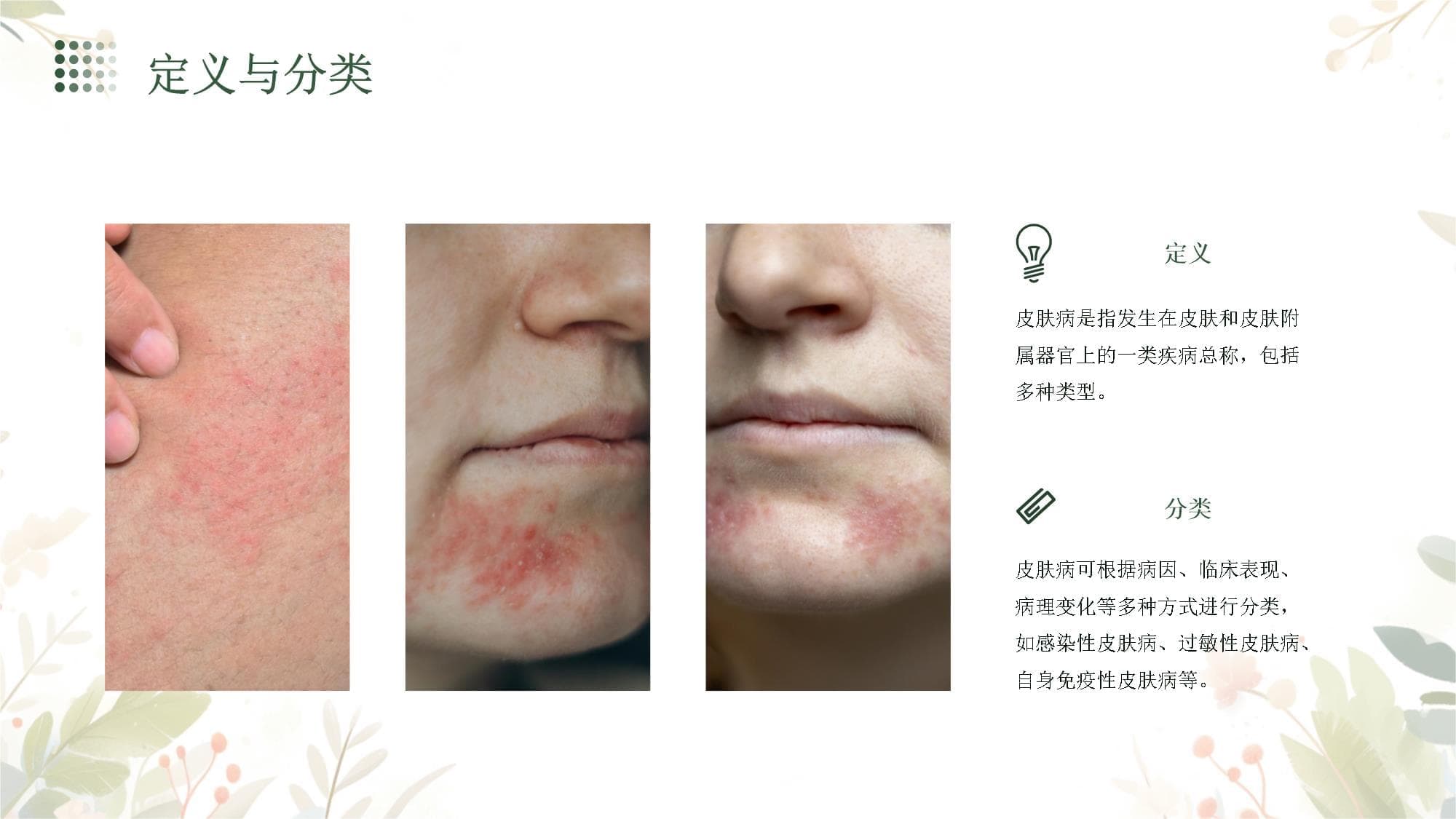 皮肤病的健康指导