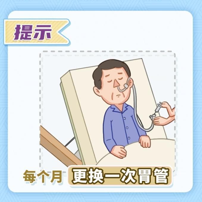喉切除手术后，鼻饲营养要了解三个方面！