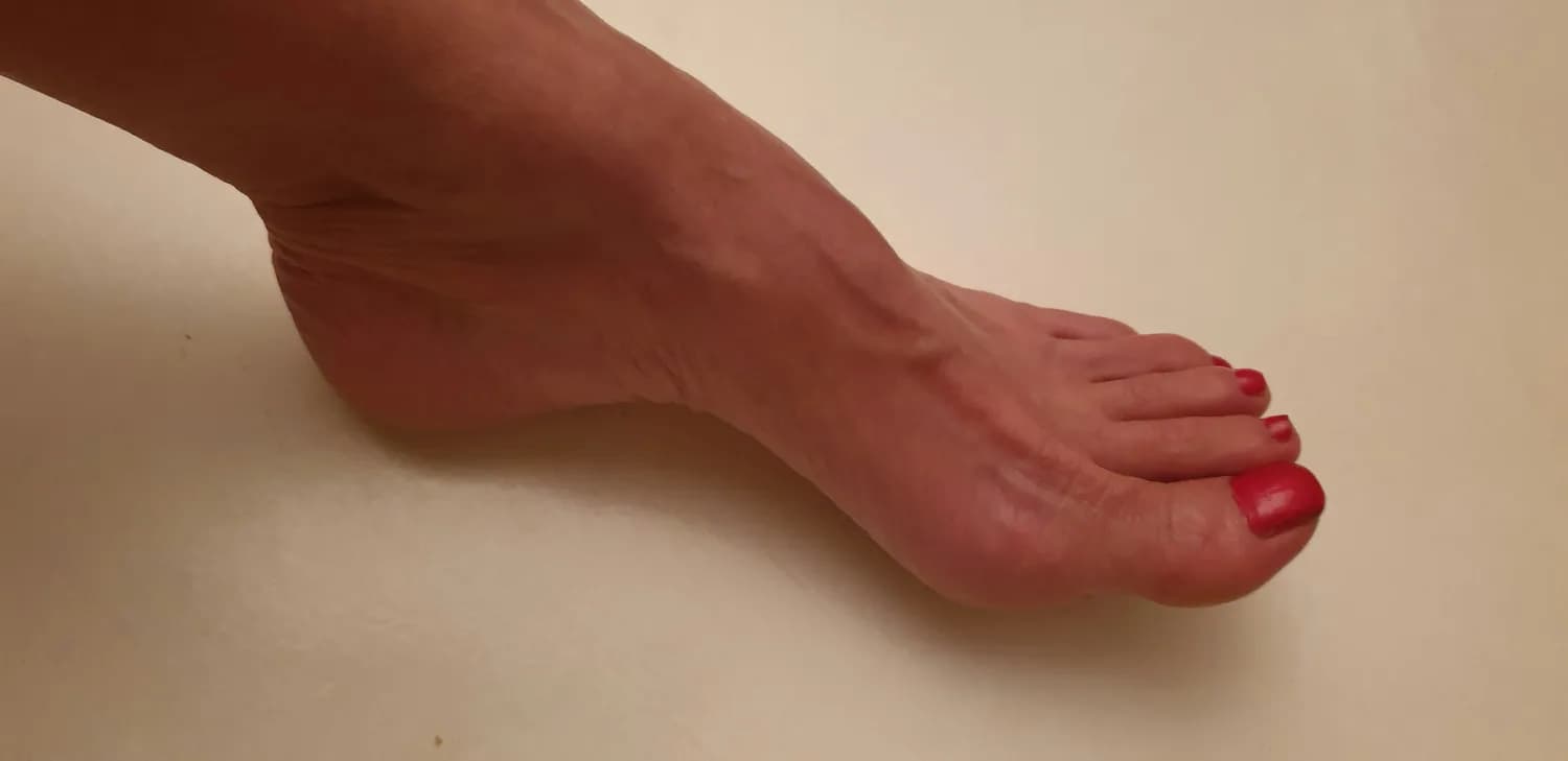 中医师杨苡琪教你：春节后快速消肿的实用秘诀