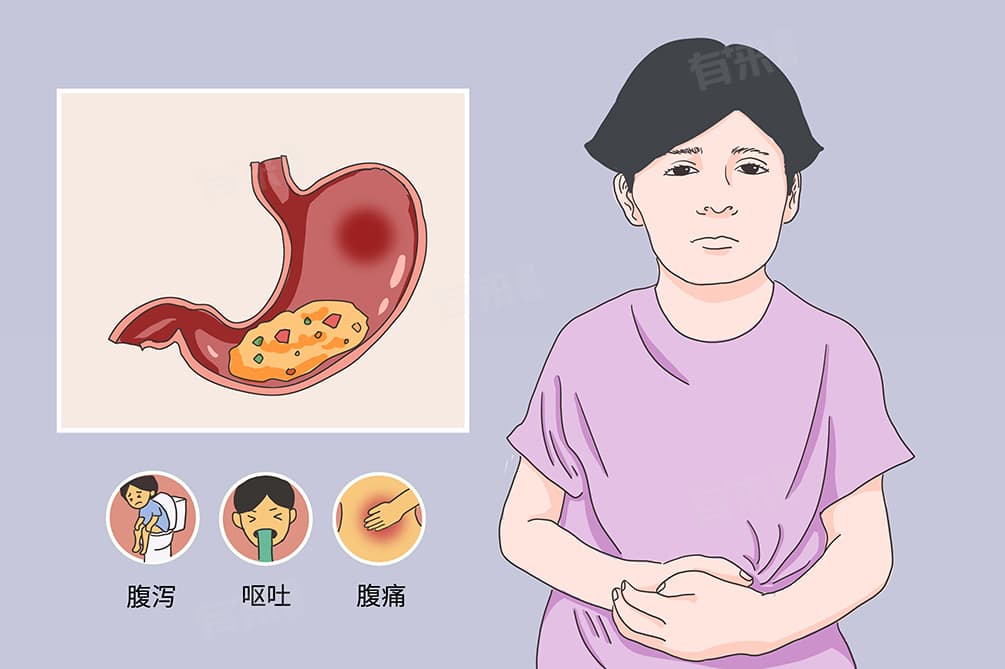 急性腹泻病程一般多久