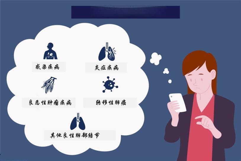 肺结节知识早知道