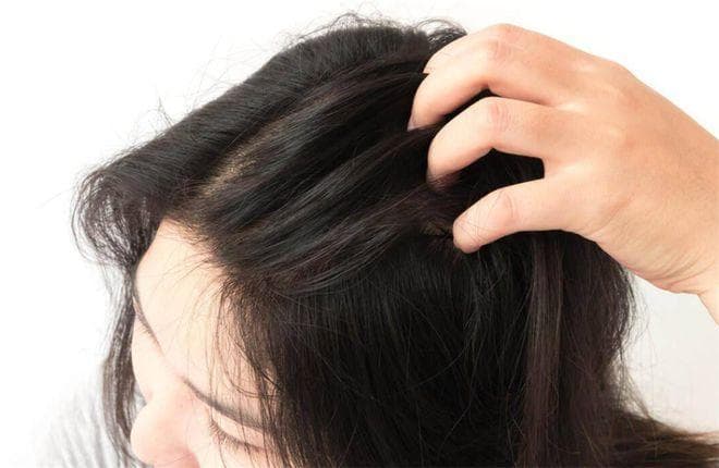 秋季头皮干燥瘙痒，如何才能缓解？这些妙招学起来