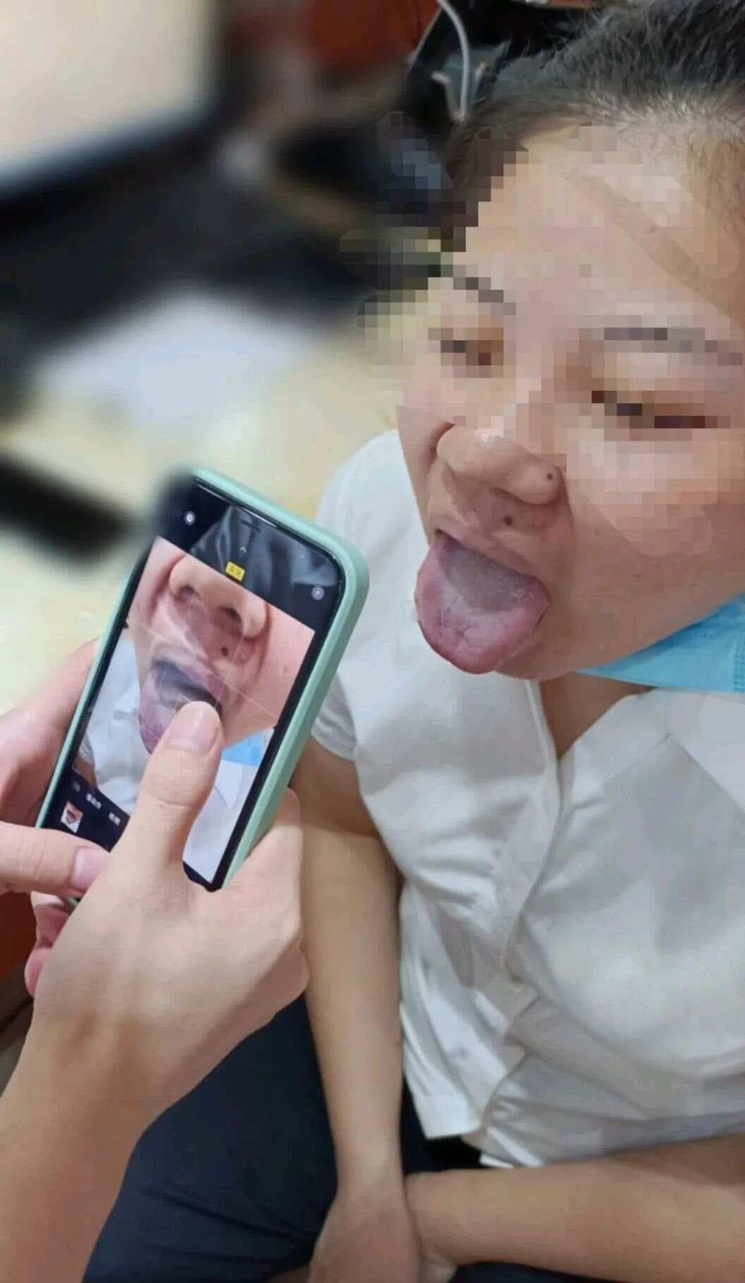 张仲景舌诊条文精解：六条经典论述及其临床应用