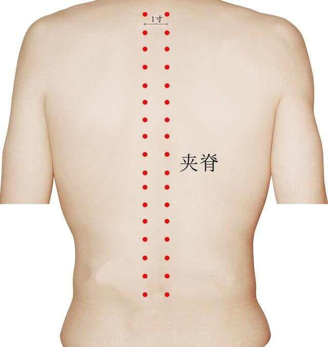 神奇夹脊穴，又称华佗穴，中医治疗腰痛腿麻的要穴，值得了解
