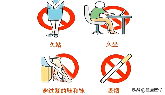 下肢静脉曲张治疗全攻略：口服药和外用药详解