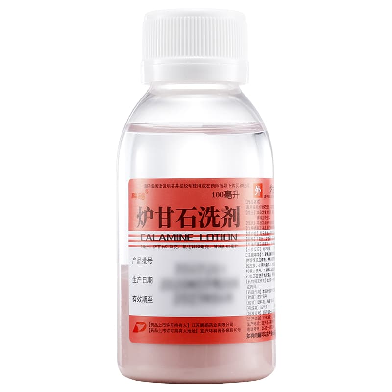 炉甘石洗剂的适应症及适用人群