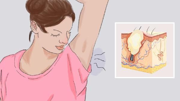 女生体味重但不是狐臭怎么办？