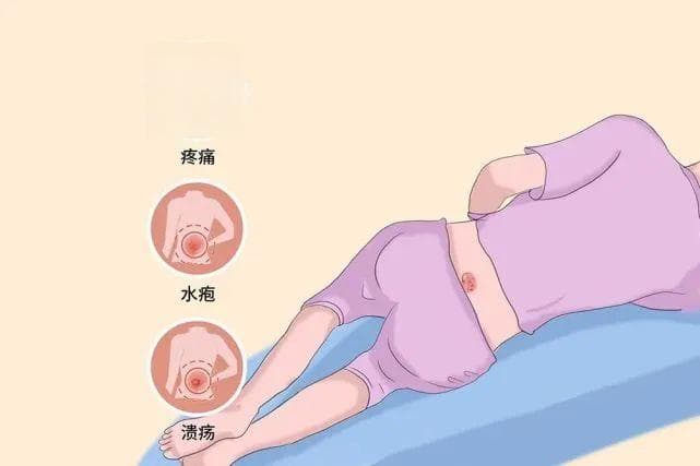 关注压力性损伤，守护肌肤健康