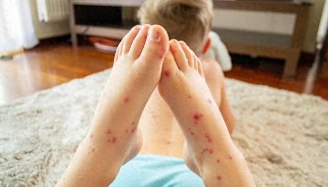 宝宝一吃鸡蛋就起疹子还腹泻，怎么回事，难道以后都不能吃了吗？