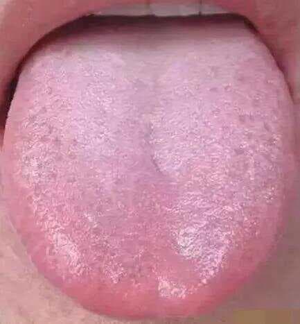 舌苔辨证大全：一张图洞悉健康奥秘