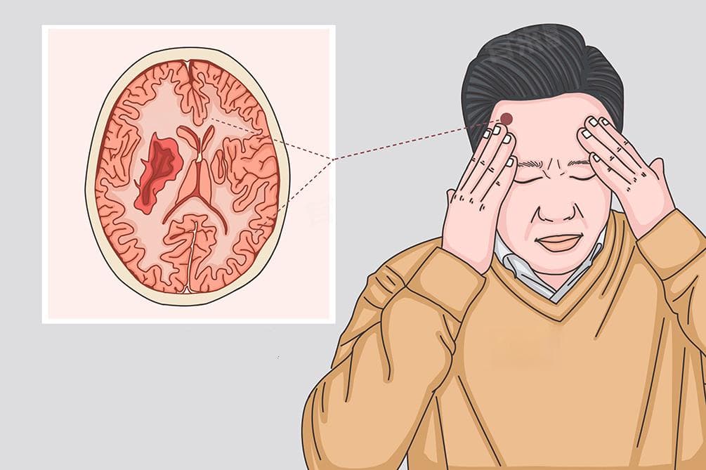 开颅手术后非常痛苦吗