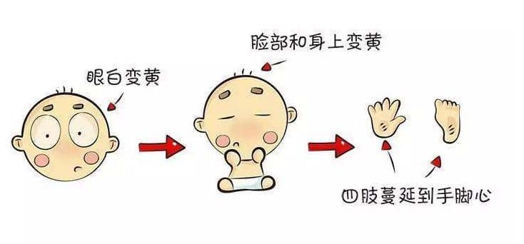新手爸妈必备！《新生儿常见疾病护理指南》