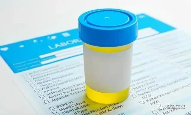 尿常规11项检查的临床意义