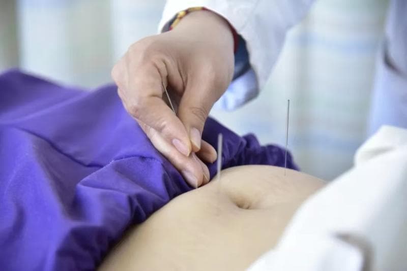 针灸、拔罐……中医外治疗法 抵御冬季流感有妙招！
