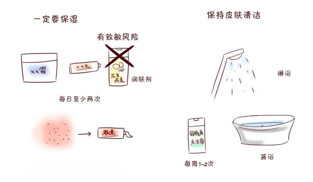 世界特应性皮炎日│儿童湿疹：科学用药与细心护理