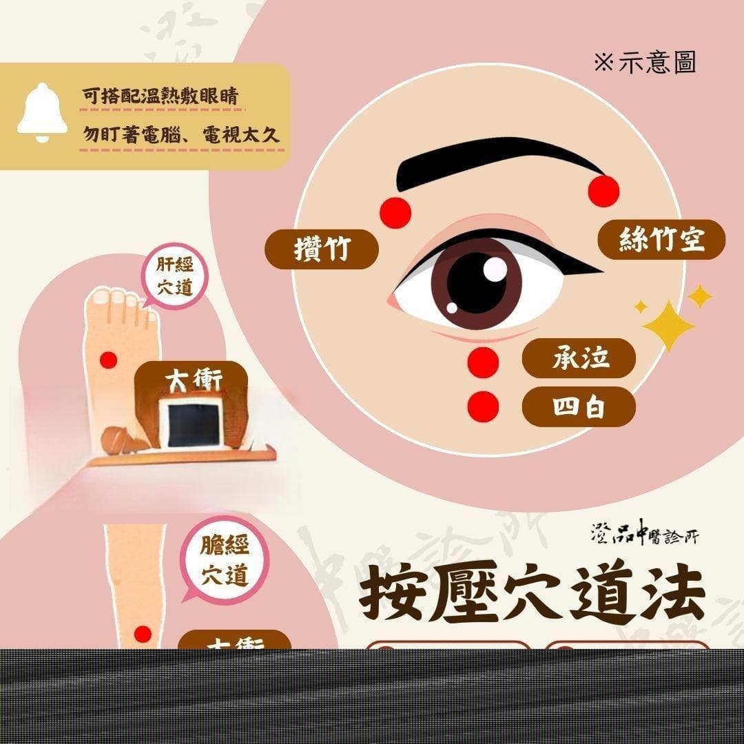 飞蚊症怎么预防？中医推荐按压护眼6穴道，如出现“这种程度”视模糊，立即就医！
