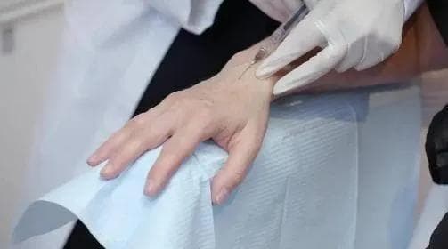 “封闭针”到底是什么？打了之后对身体有什么影响？不妨了解下