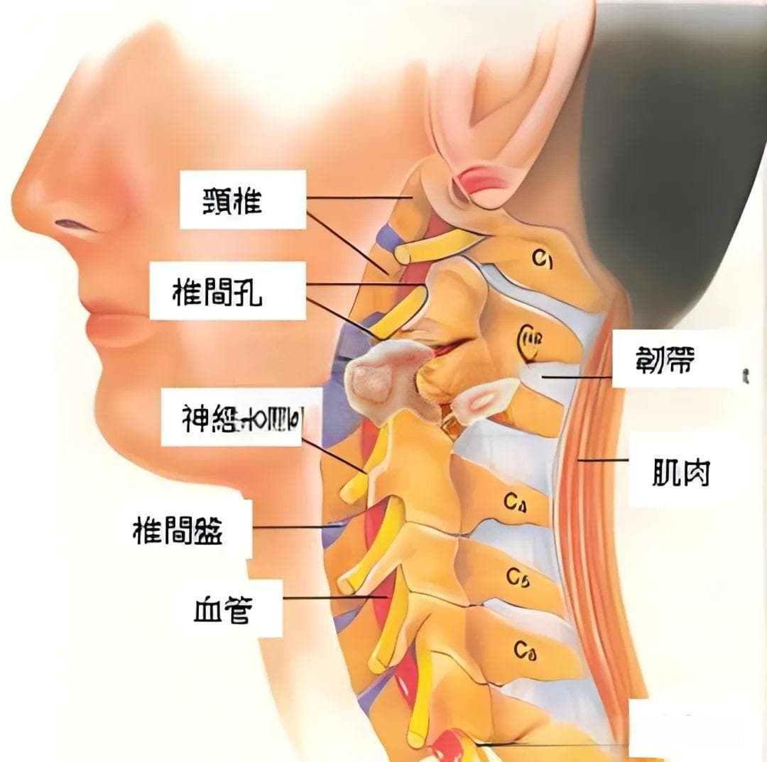 3分钟掌握：颈椎病的七大相关知识点