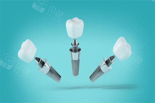 今年种植牙新农合可以报销吗？新政策是什么？了解价格建议看正规医院收费标准！