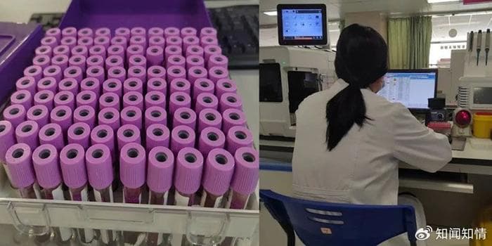 血红蛋白含量与贫血的关系：从血常规检查读懂身体状况
