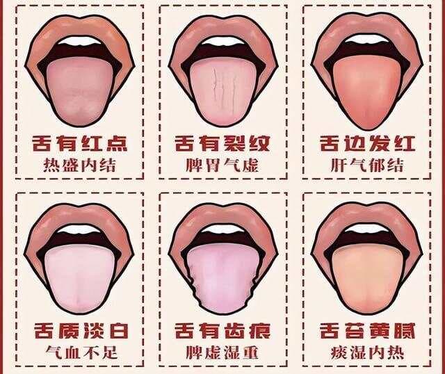 中医通过舌头和把脉，到底可以看出什么问题呢
