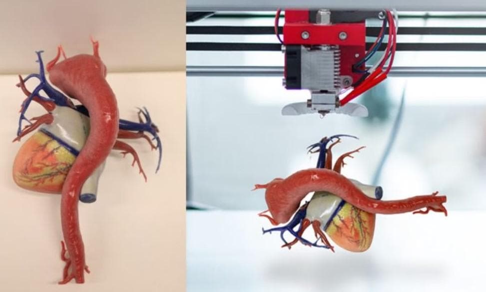 外科医生利用3D打印心脏模型治疗心血管异常