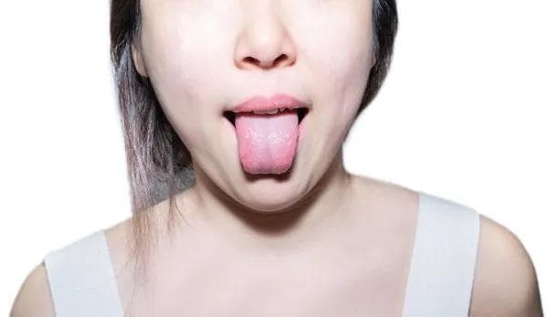 口干舌苔厚白是什么原因 怎么解决