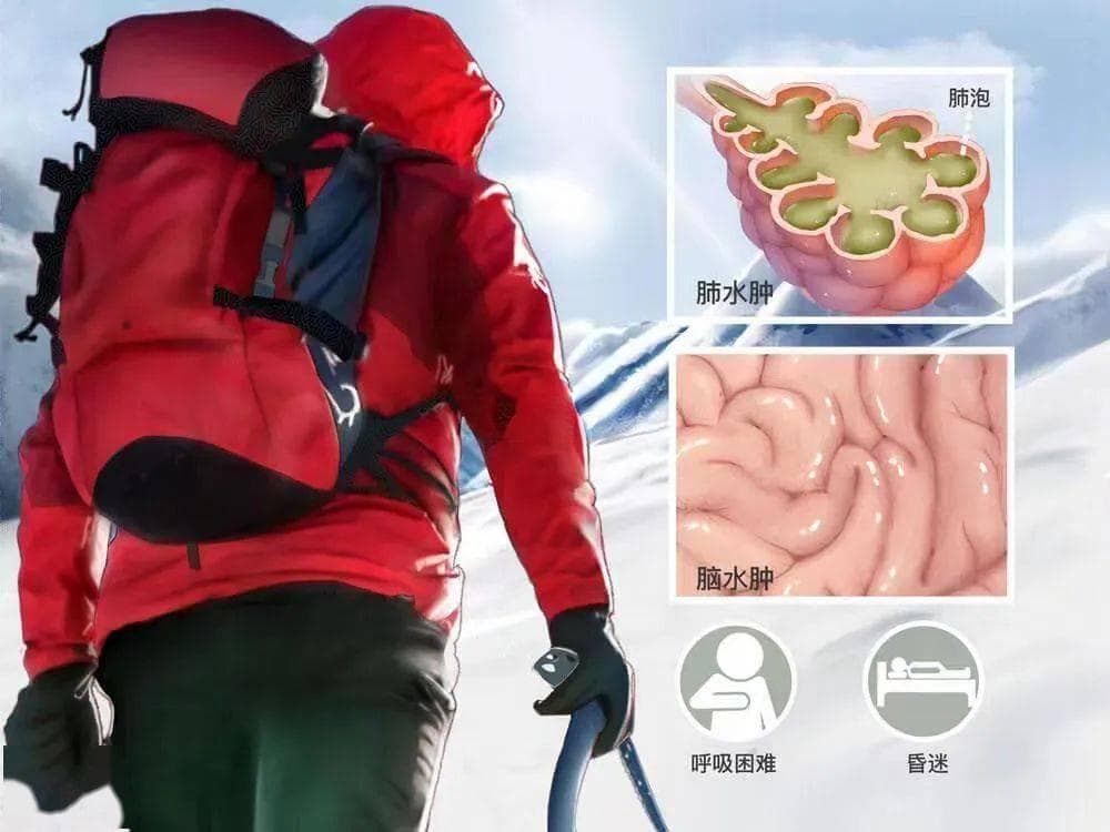 暑期高原旅游激增，专家详解高原病防治：高压氧治疗是关键