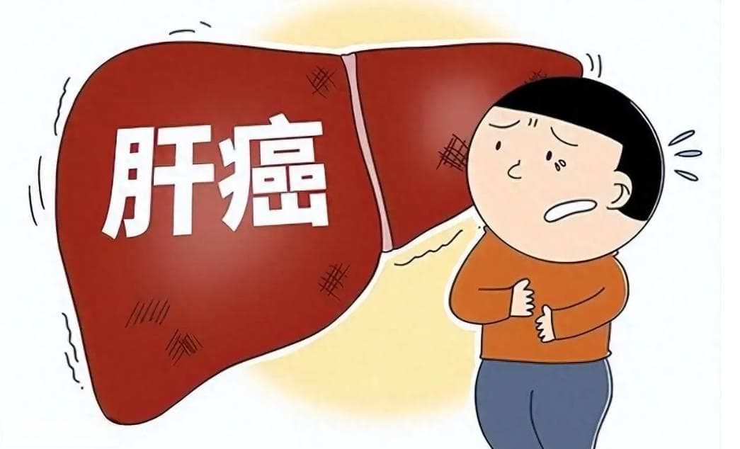 肝脏守护者：如何通过检查早期发现肝癌