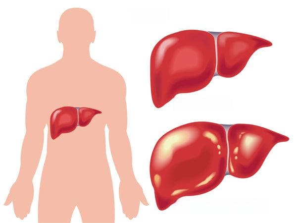 肝硬化和结核性腹膜炎腹水区别是什么