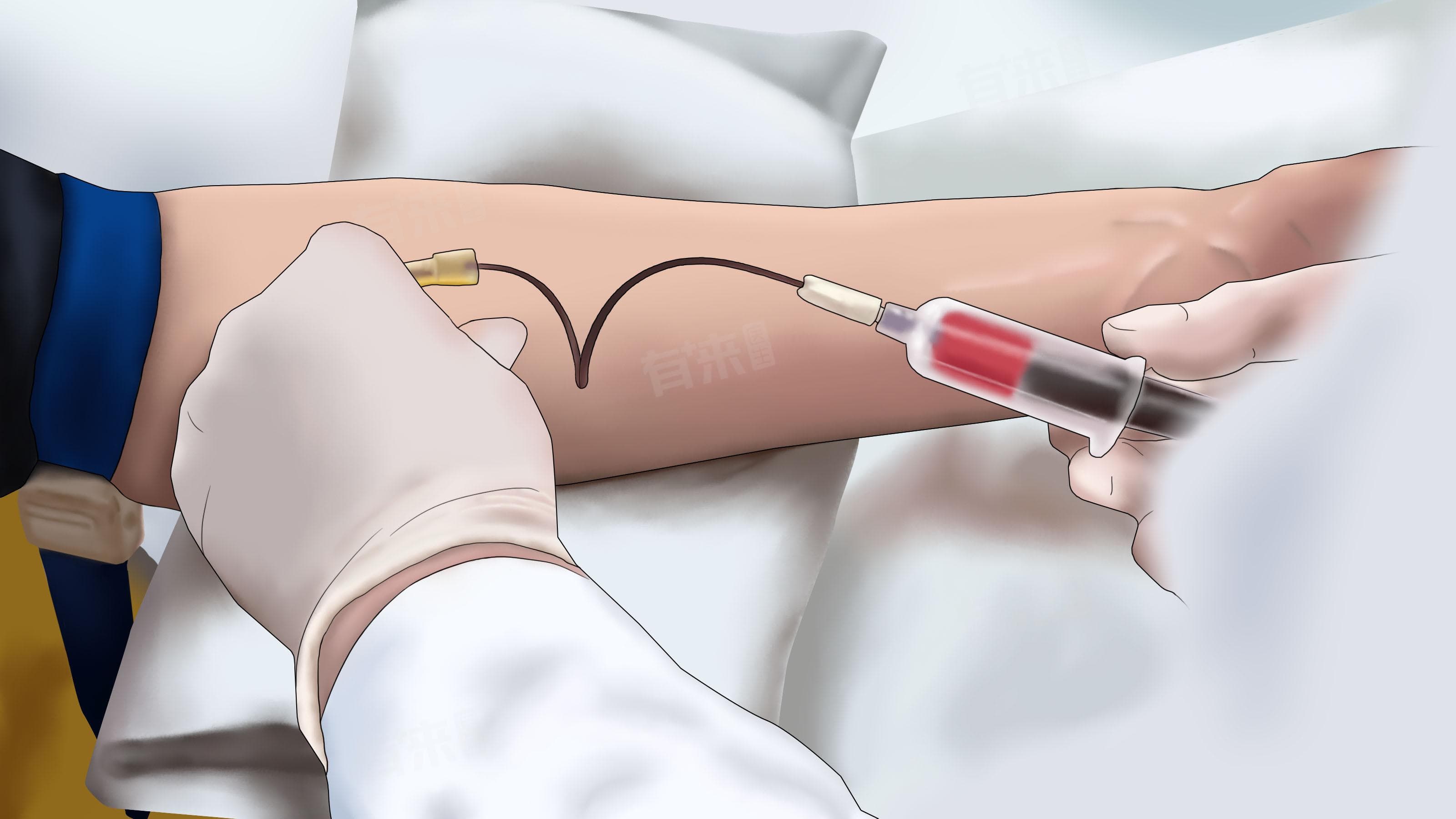 健康证查HIV吗