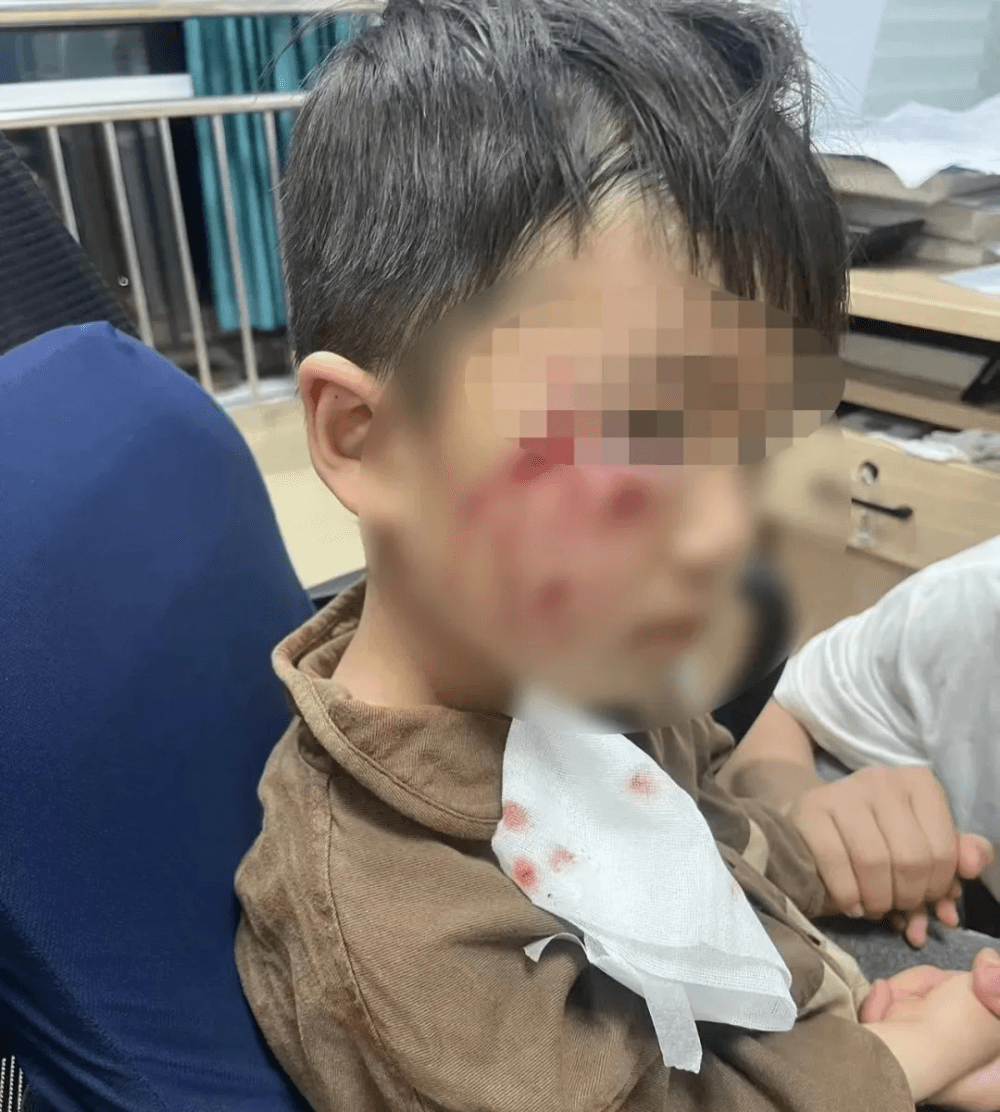 警惕犬只伤人 被犬袭击后这样处理