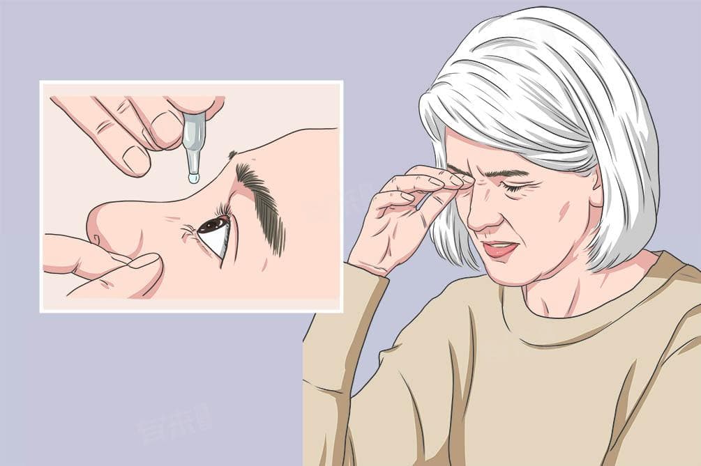 干眼病用什么治疗好