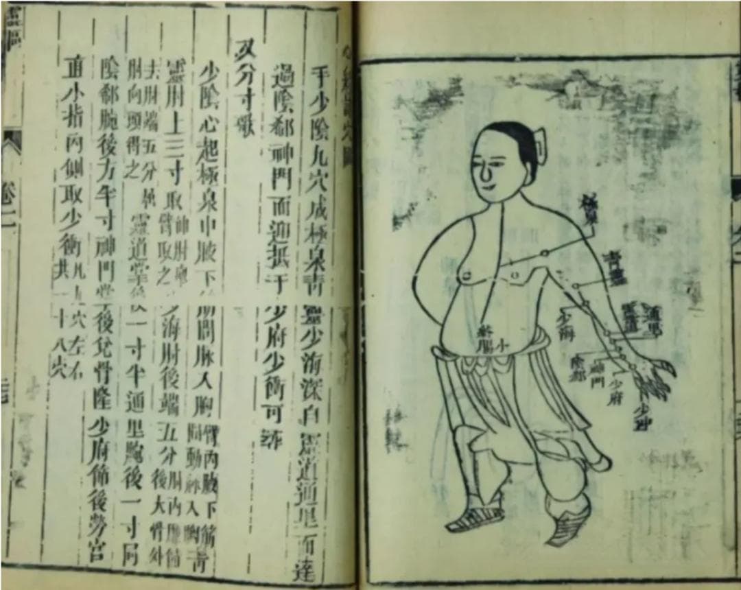 针灸可以治哪些病？世界卫生组织推荐的针灸治疗范围