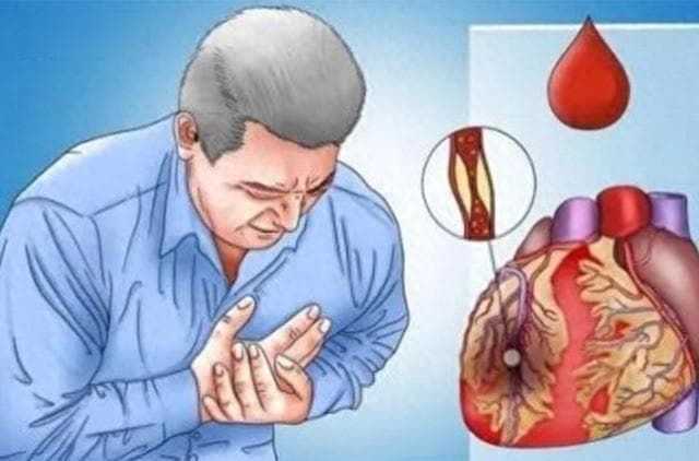“胸痛”--急诊室的头号致命杀手