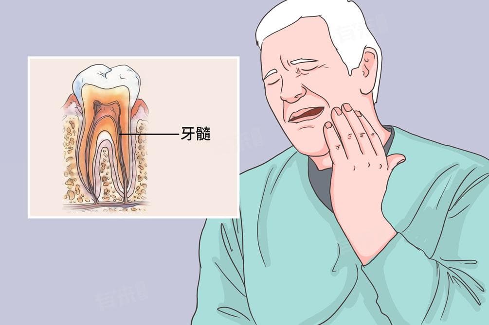 牙髓炎晚上痛怎么办？4个实用缓解方法+日常预防指南