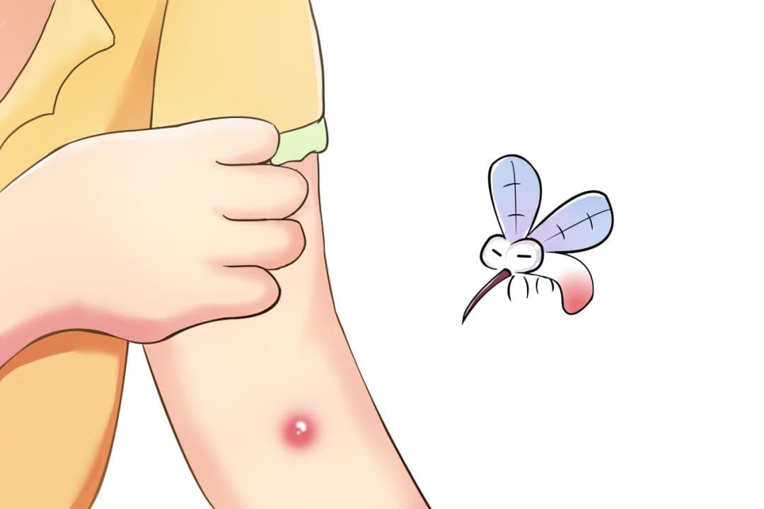 蚊虫叮咬-如何处理、预防策略（科普）