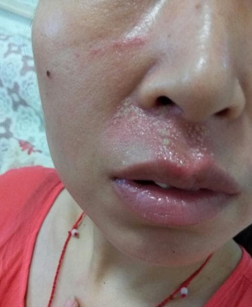 梦见被咬醒来还有痛感
