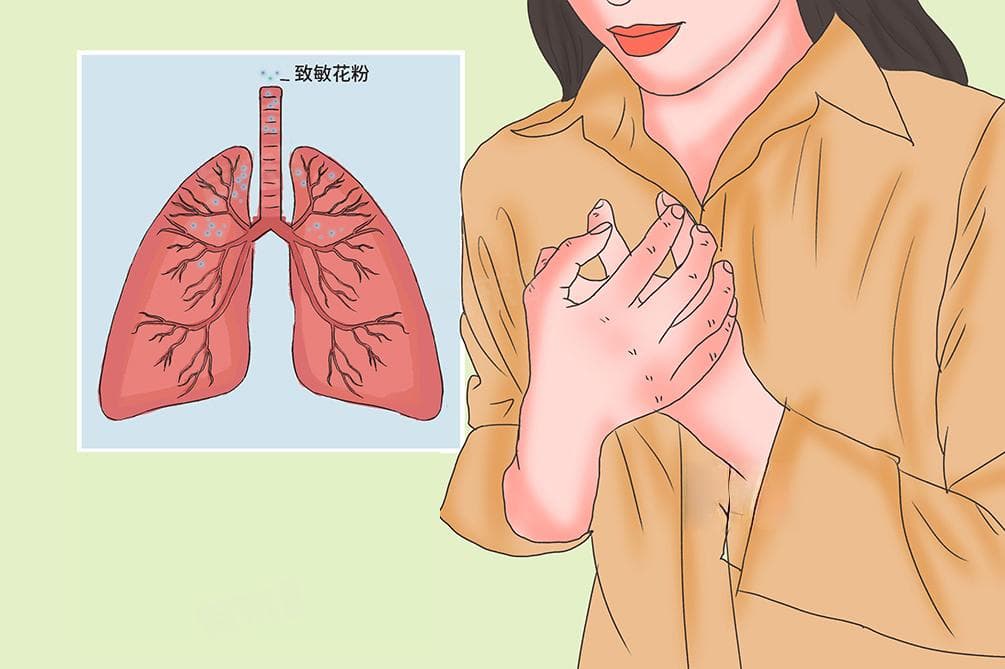 人对花粉过敏原因及应对方法