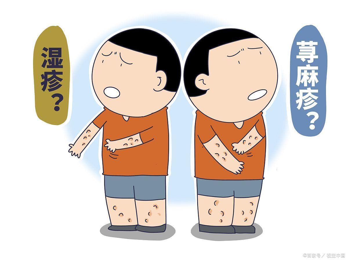 正确认识荨麻疹：从发病机理到日常护理