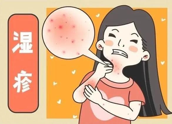 朱丹自曝对鸡蛋过敏！湿疹患者需警惕这些食物