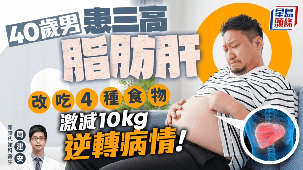 40岁男性患三高严重脂肪肝，医生教吃4种食物成功减重10公斤逆转病情