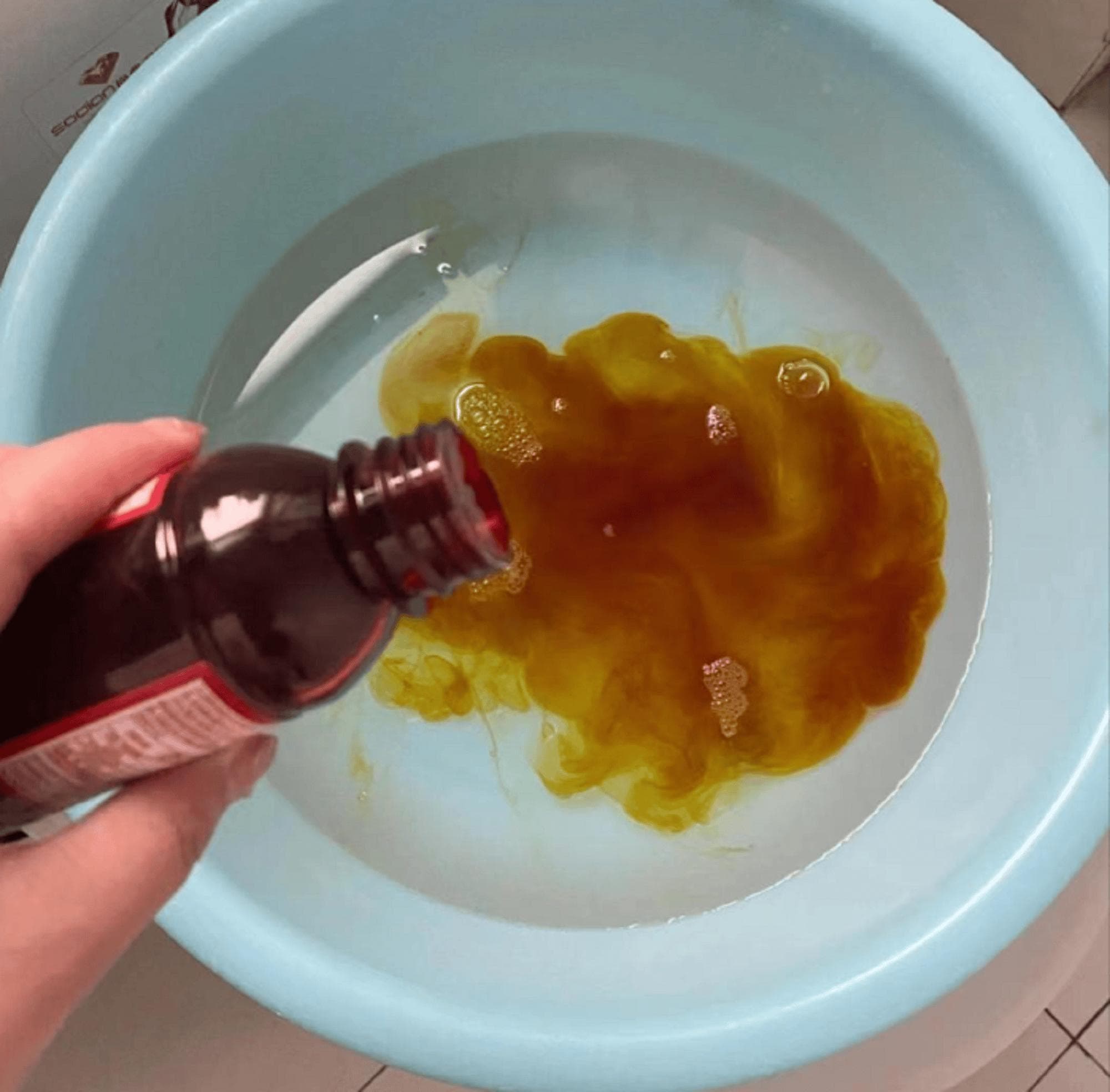 碘伏泡脚能治灰指甲？真的吗？（真实经验分享）